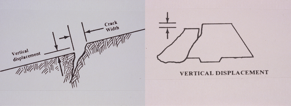 Diagram side view of severe vertical displacement