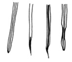Drawing of roots afflicted by red stele root rot
